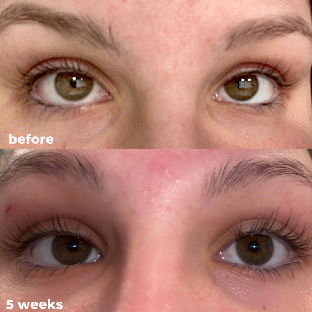 Eyelash Serum 8ml